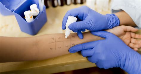 how to check allergy test